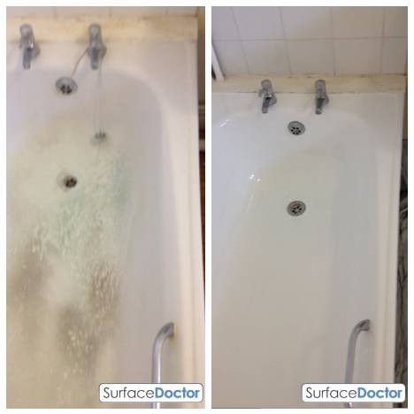 Bath resurfacing in Dalkeith by Surface Doctor
