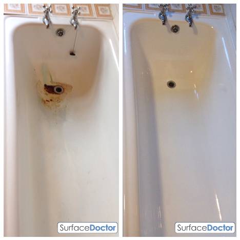 Surface Doctor bath repair van in Dalkeith